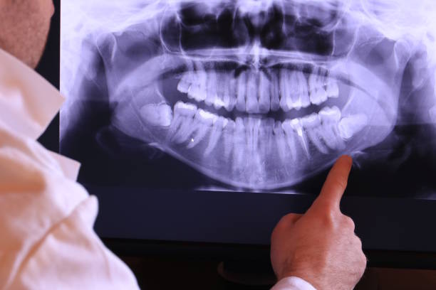 Best Emergency Root Canal Treatment in Sarcoxie, MO