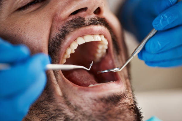 Best Emergency Broken Tooth Repair in Sarcoxie, MO